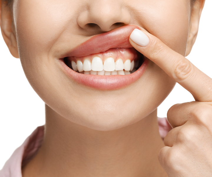 What Dental Problems Can Gum Contouring Fix?